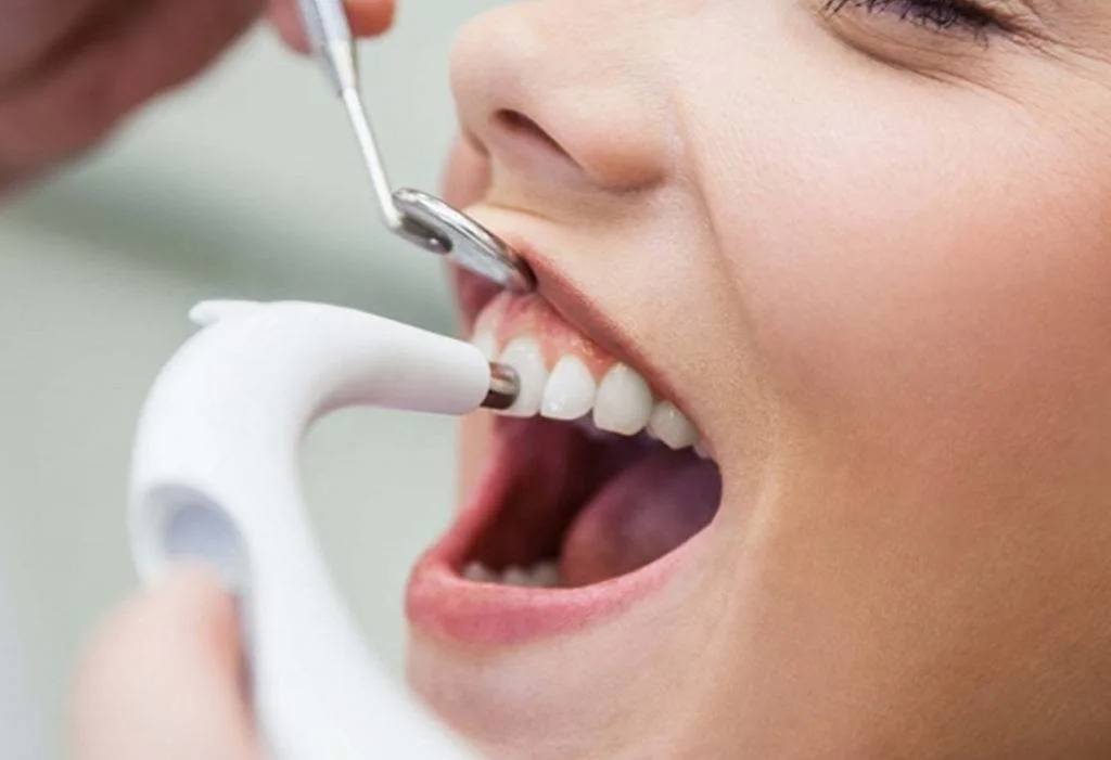 Teeth Cleaning & Polishing in Pune
