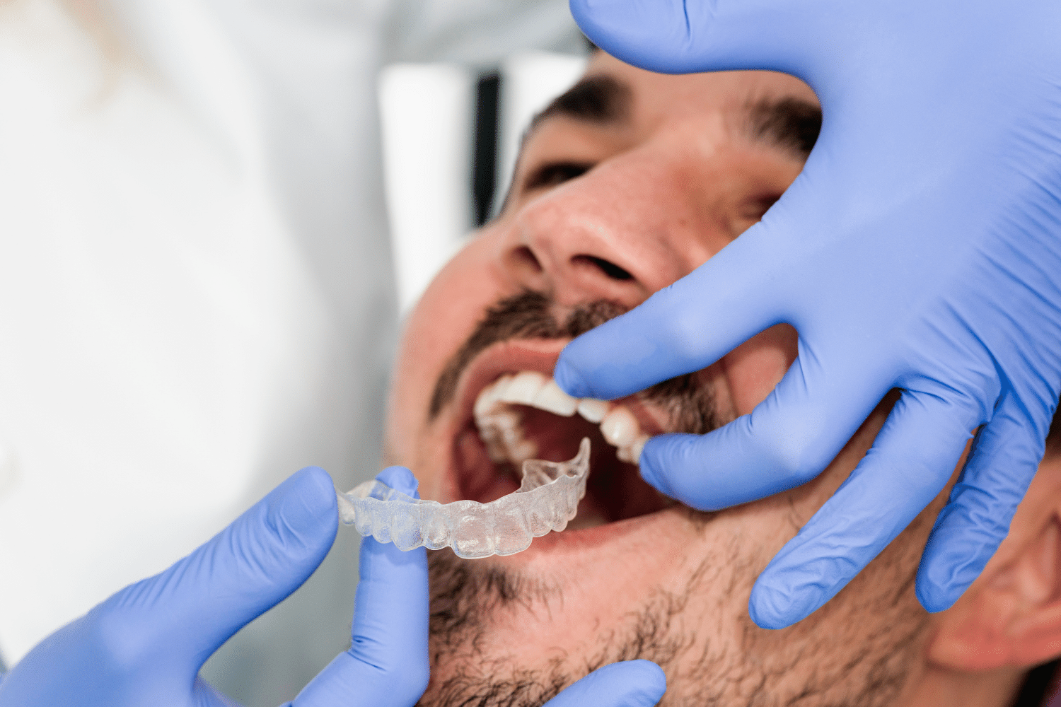 Dentist checking fit of clear aligners in clinic