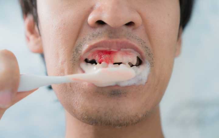 Gentle brushing technique using a soft toothbrush to prevent enamel wear and gum recession